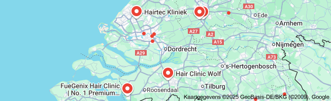 Alles wat je moet weten over haartransplantatie: Een diepgaande gids voor haarverliesbehandeling