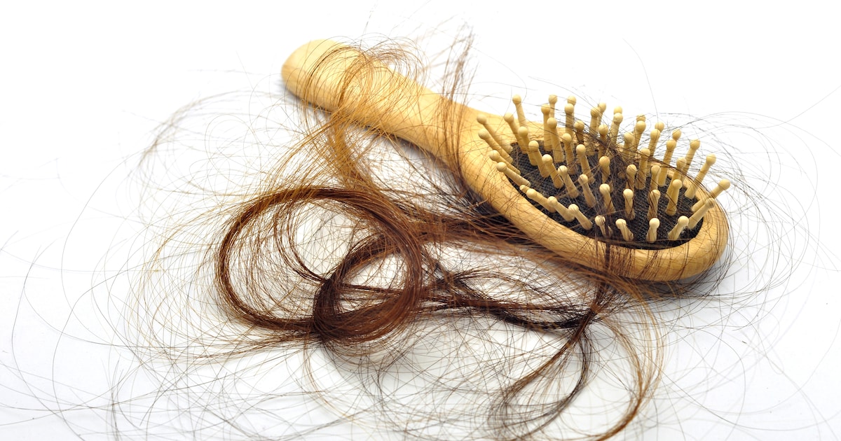 Haaruitval bij vrouwen tijdens de menopauze: Een veelvoorkomend fenomeen