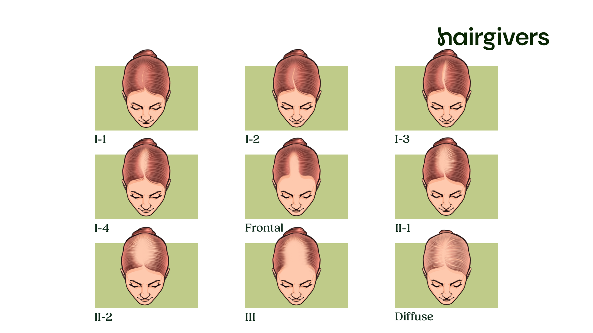 Effectieve tips om haaruitval tegen te gaan