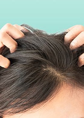 Oorzaken van haaruitval bij vrouwen: Een veelvoorkomend probleem met emotionele impact