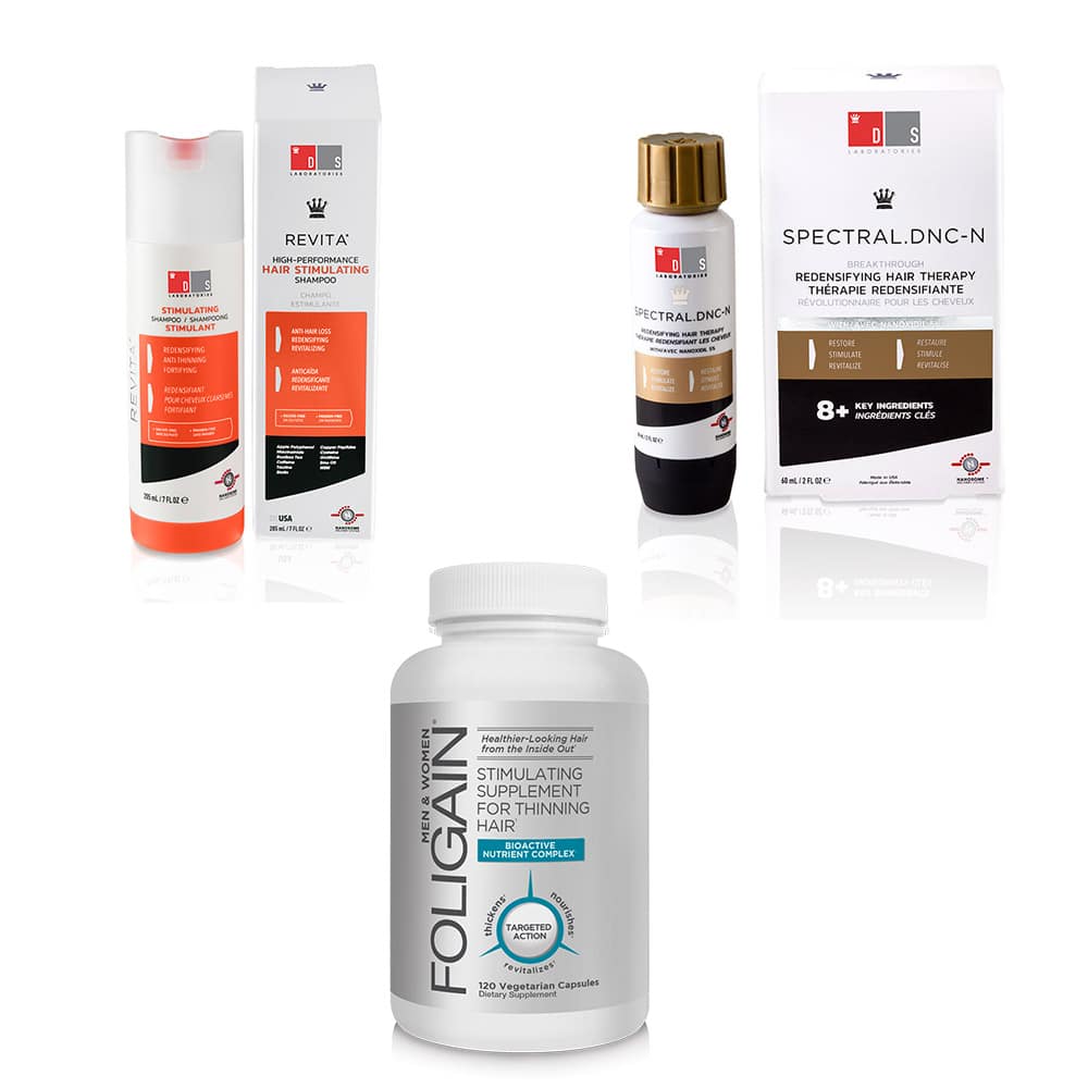 Hoopvolle Oplossingen Tegen Haarverlies: Herwin Je Stralende Haardos!