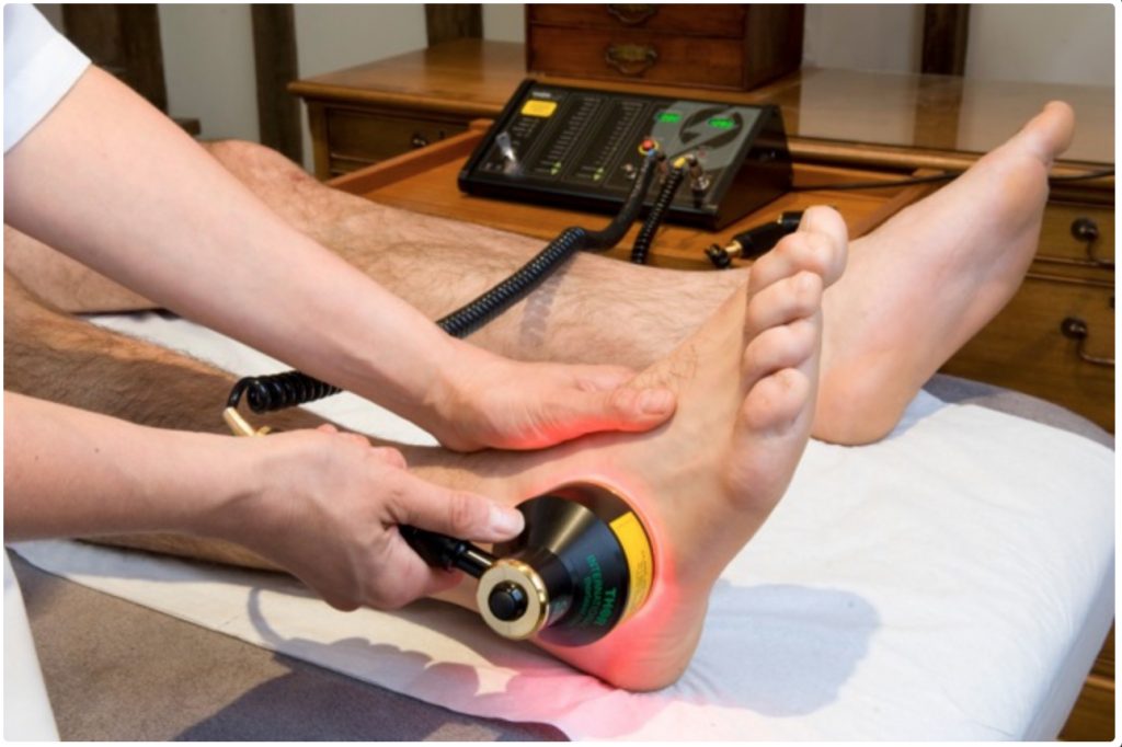 Haaruitval behandelen met low level laser therapie: Een innovatieve oplossing