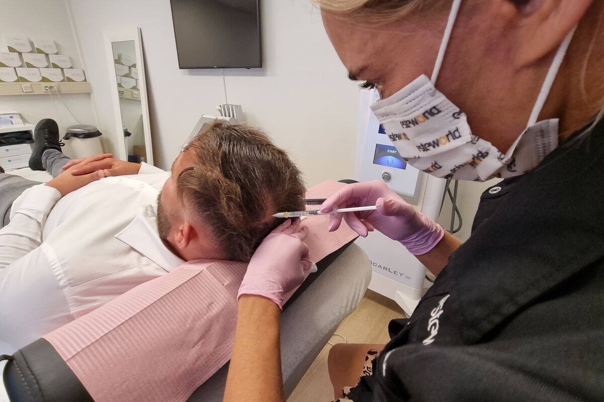 Ervaringen met Mesotherapie voor Haar: Wat Kunnen Mensen Verwachten?