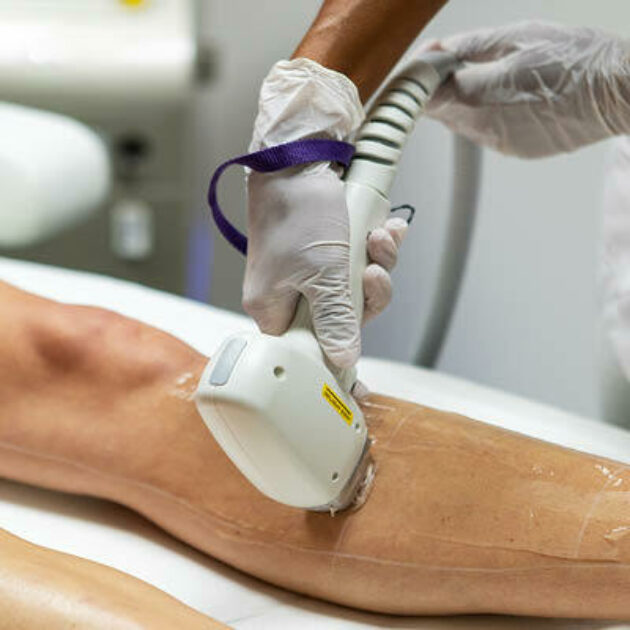 Haargroei stimuleren met innovatieve lasertherapie