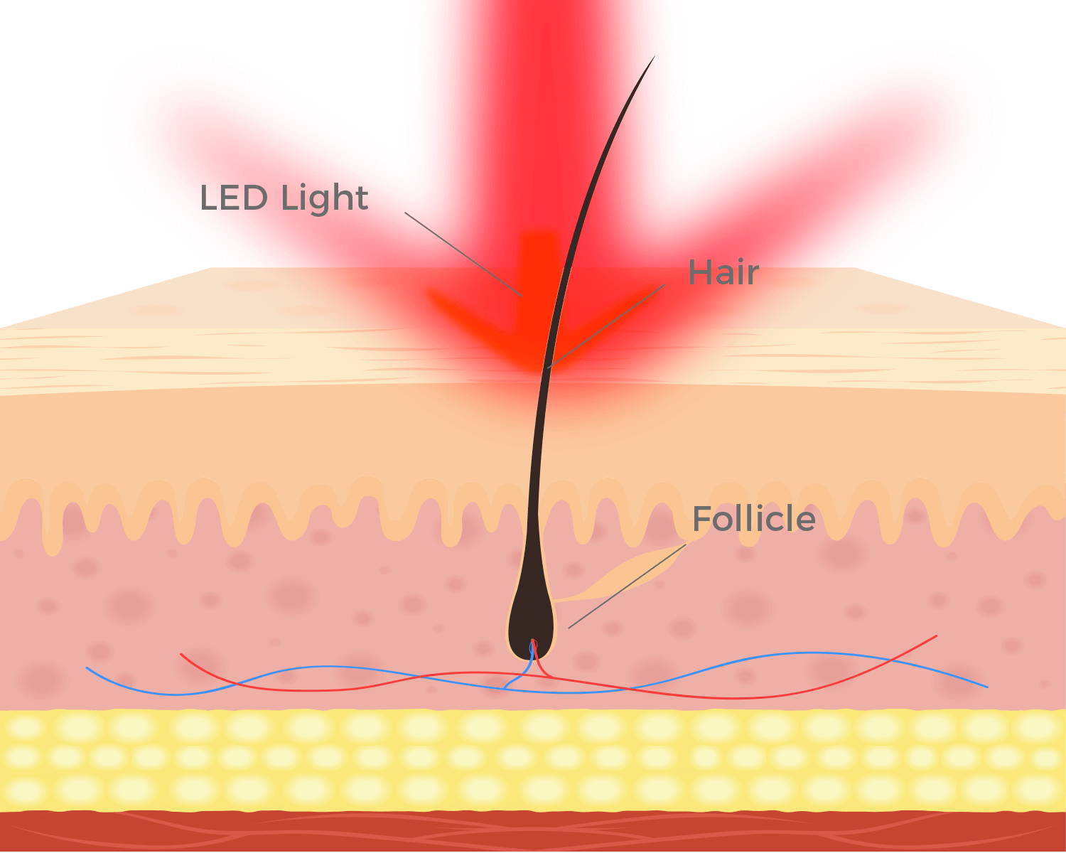 Ontdek de Kracht van Lasertherapie voor Haargroei!