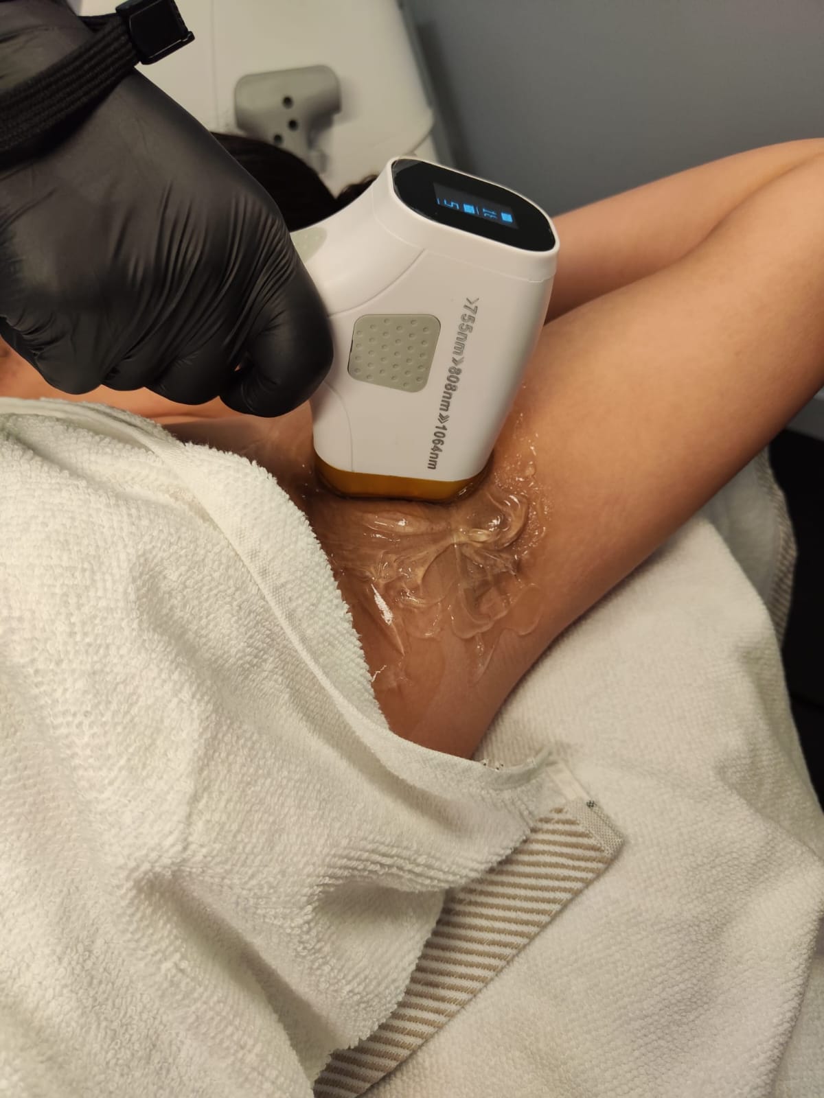 Efficiënt Ontharen met Laserbehandelingen: Ontdek de Voordelen van Laser voor Ontharing