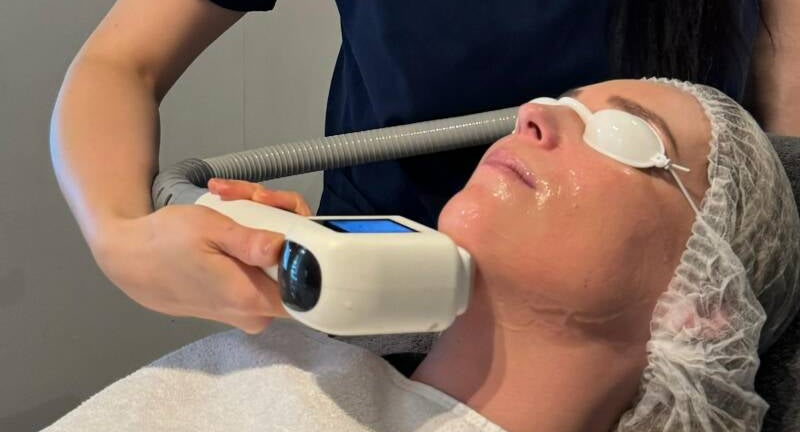 Effectieve Laser Ontharen voor een Glad Gezicht: Ontdek de Voordelen!