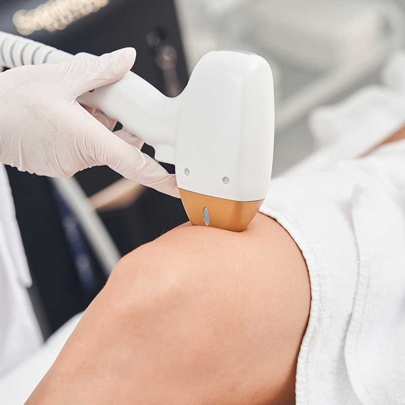 Veilige en Effectieve Laser Ontharen voor de Schaamstreek