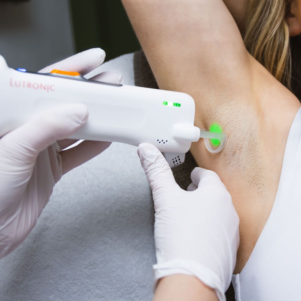 Effectieve Laserbehandeling voor Gladde Oksels: Ontdek de Voordelen