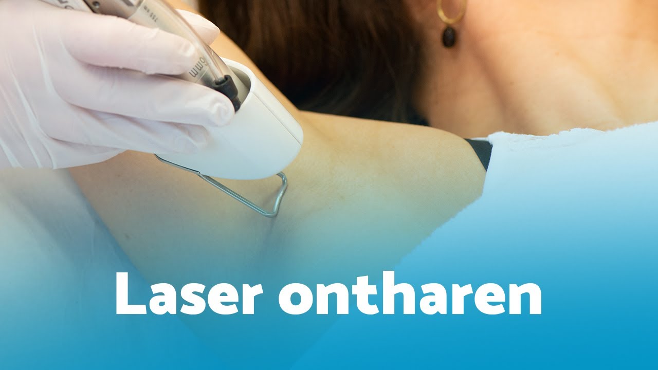 Kosten voor Rughaar Laseren: Wat U Moet Weten