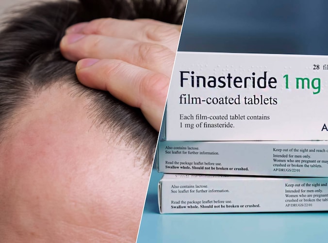 Echte Haargroeipillen Bestaan Eigenlijk Niet: De Waarheid Over Haaruitvalbehandelingen