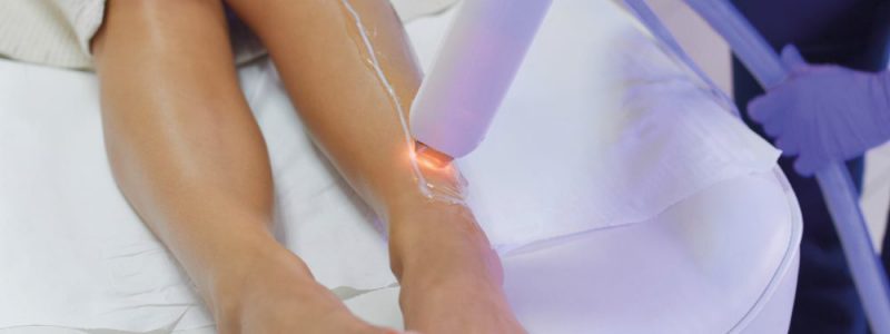 Wordt bestaand haar inclusief haarzakjes door de laser effectief vernietigd?