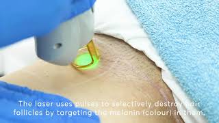 Bikinilijn ontharen met laser: behandeling, voorbereiding en resultaat