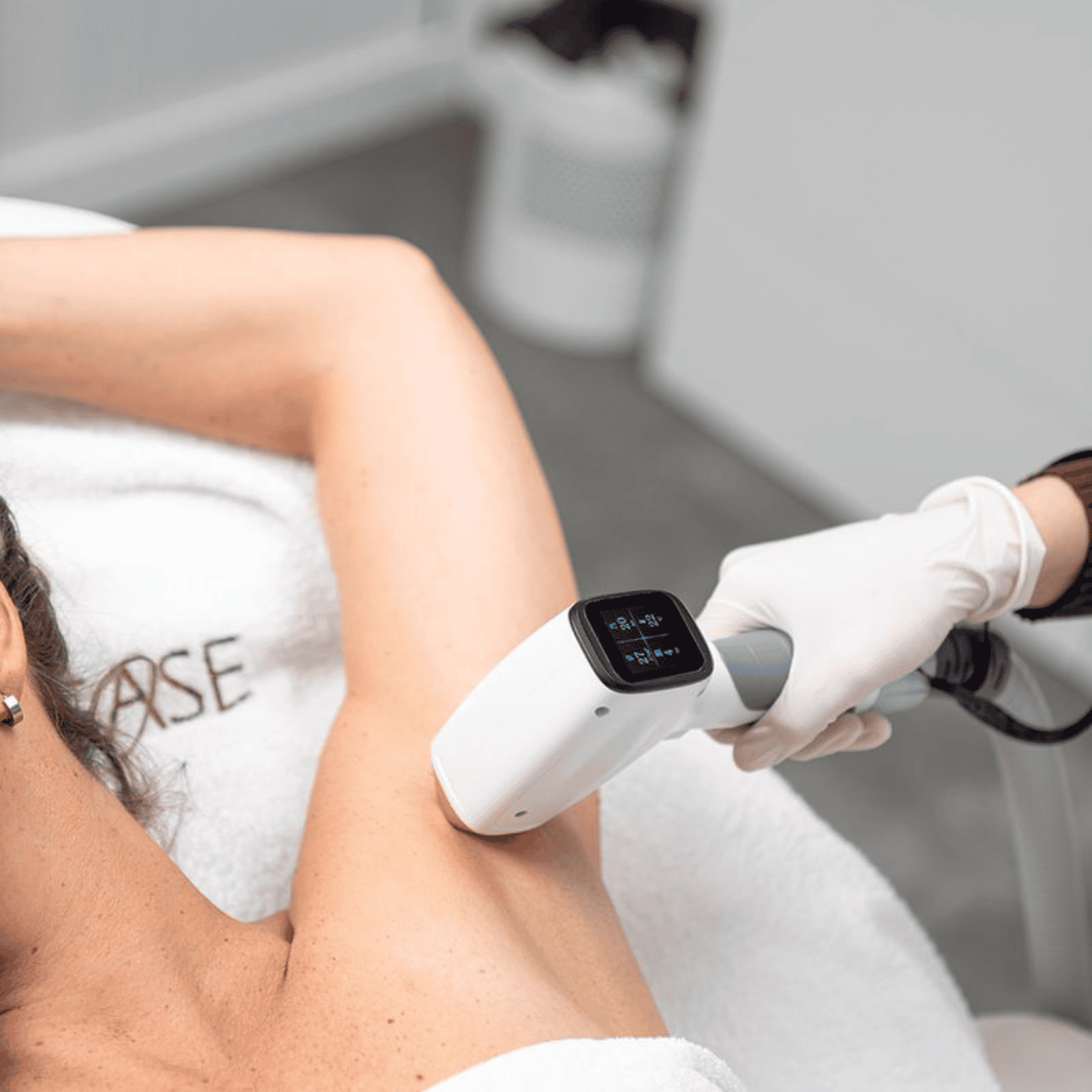 Oksels ontharen met laser: alles over de behandeling